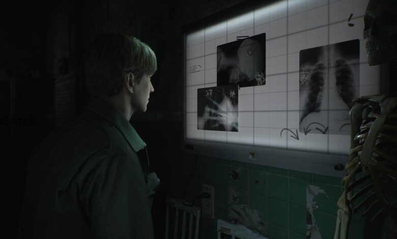 ویدیو: مقایسه‌ی Silent Hill 2 Remake با نسخه‌ی اصلی – تی ام گیم