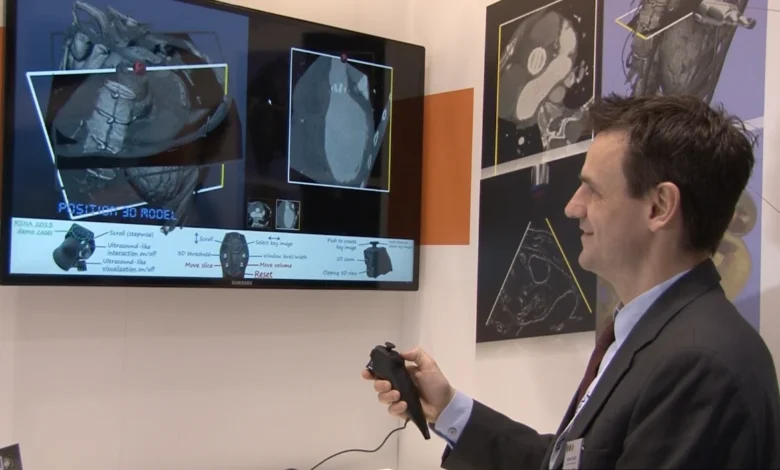 Xbox Kinect هنوز هم در سی‌تی اسکن بیمارستان کاربرد دارد – تی ام گیم